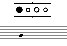 2E4P-16tel-1000