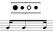 2E4P-16tel-1101